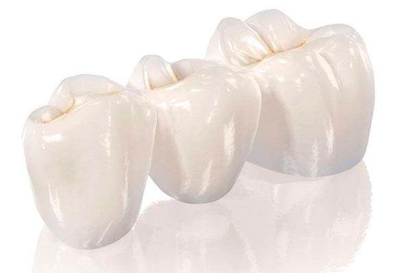 Керамические коронки на зубы. Преимущества и недостатки