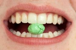 Как нельзя бороться с зубным камнем