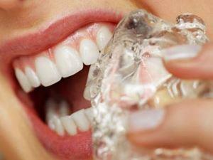 Почему зубы становятся чувствитеьными