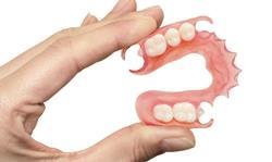 Что такое временные зубные протезы