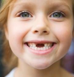 Мифы о фторе и плохие молочные зубы