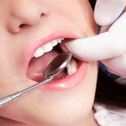 Процесс имплантации зубов. Как все происходит