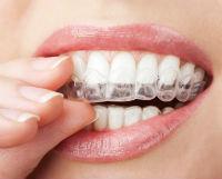 Безопасность отбеливание зубов перекисью