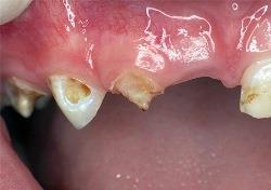 Симптомы пульпита молочных зубов