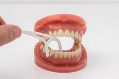 Отличия в уходе за искусственными зубами