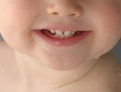 Налет на зубах у ребенка