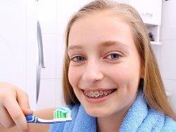 Механизм чистки зубов с брекетами