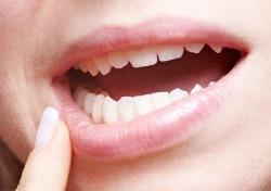 После лечения зубов с удалением нервов десны могут болеть