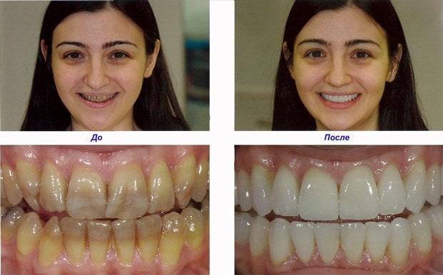 Dental prosthetics in China