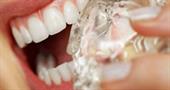 Что делать с чувствительными зубами? Советы стоматолога