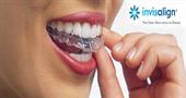 Лечение зубов каппами Invisalign