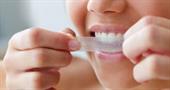 Відповіді на важливі питання щодо відбілювання зубів