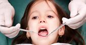 Процедура серебрения зубов у детей. Зачем это нужно?