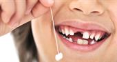 В каком возрасте у детей выпадают молочные зубы?