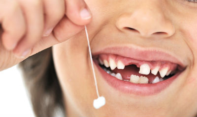 Хто вигадав термін &quot;молочні зуби&quot;?