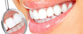 Teeth whitening